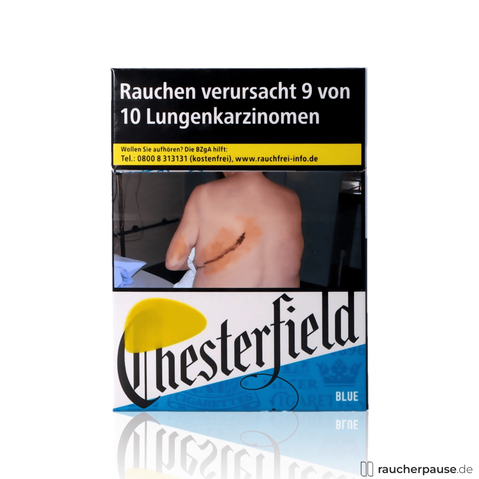 Chesterfield Blue XL Zigaretten | 24 Stk. pro Packung | King Size Format